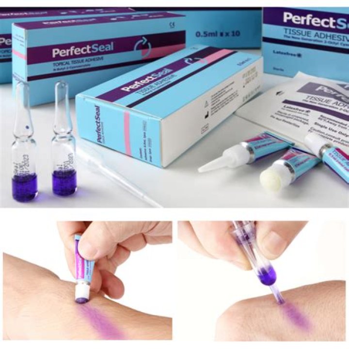 How do you remove C section glue?