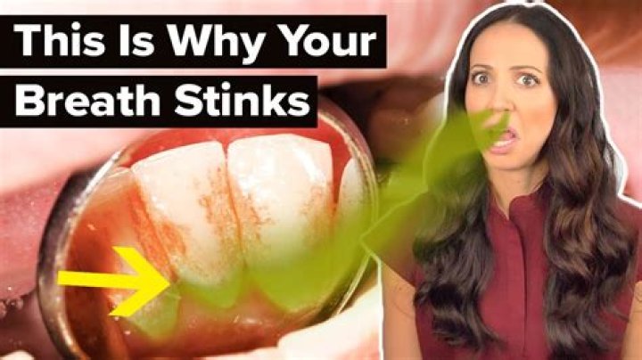 How do you tell a guy his breath stinks?