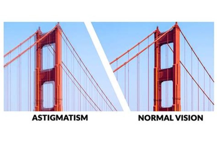 How do you treat astigmatism naturally?