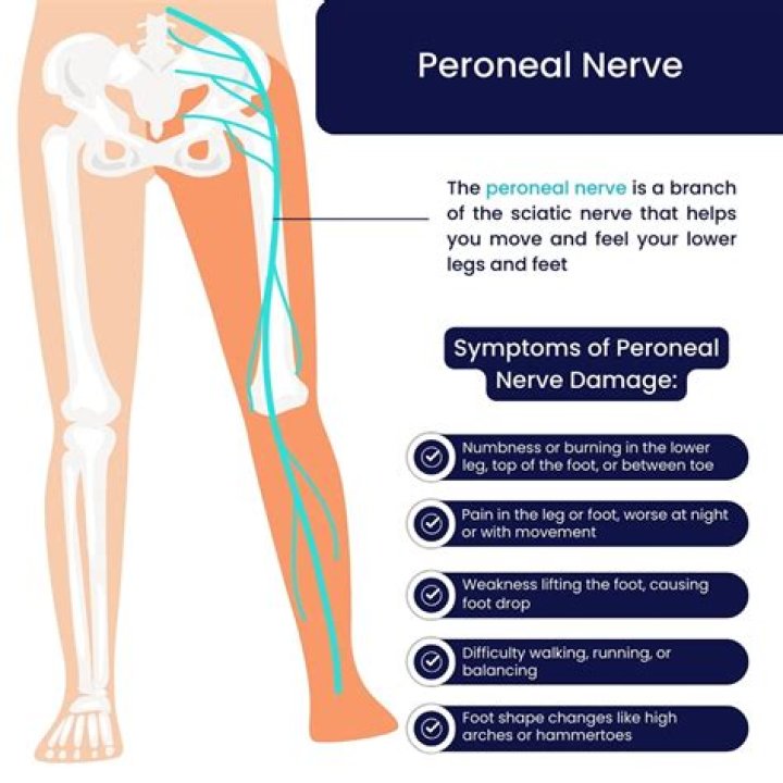 How do you treat nerve pain in your leg?