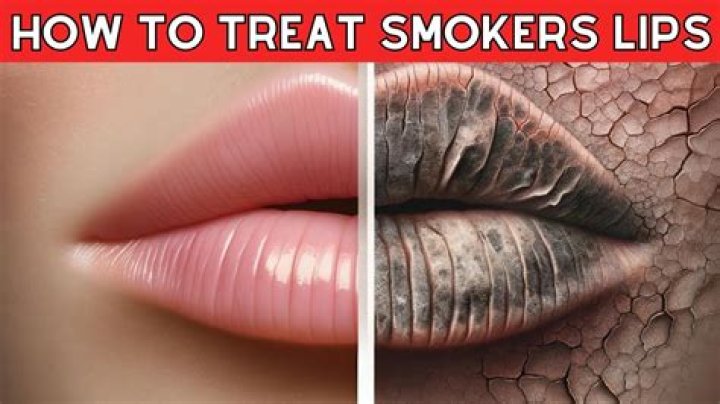 How do you treat smokers lips?