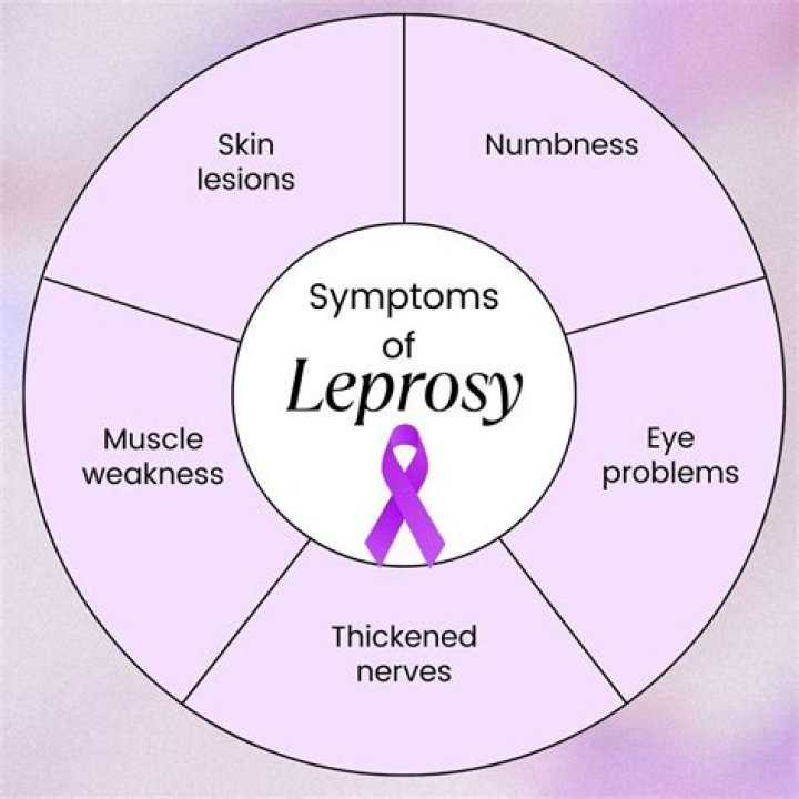 How does leprosy affect the bones?