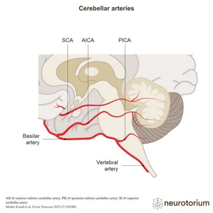 How does pica affect the brain?
