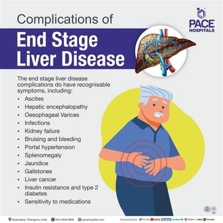 How long can a person live with mild cirrhosis?