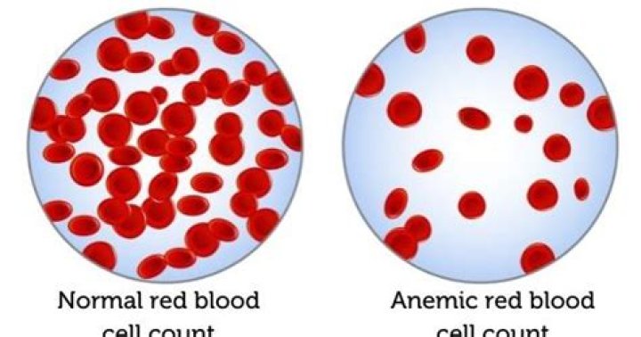 How long can anemia last?