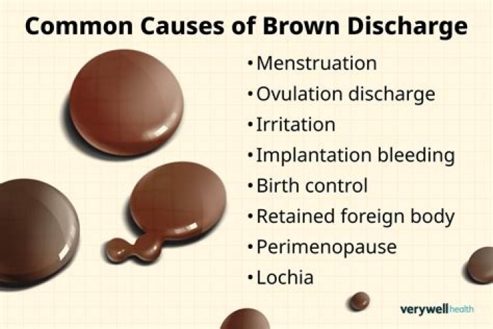 How long can brown discharge last?