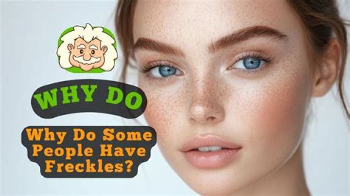 How long do freckles last for?