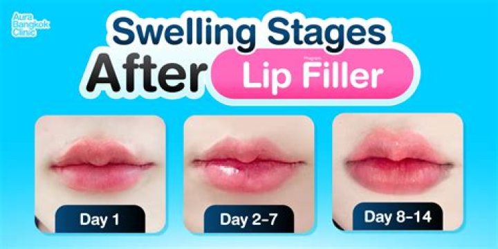 How long do lips stay swollen after lip blushing?