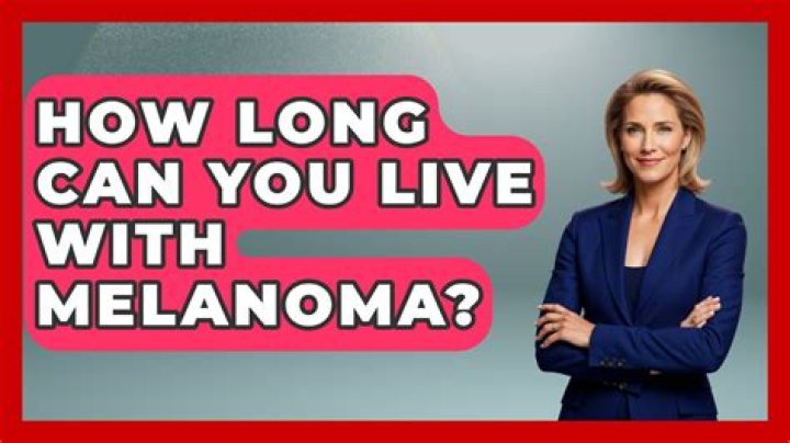 How long do you live with melanoma?