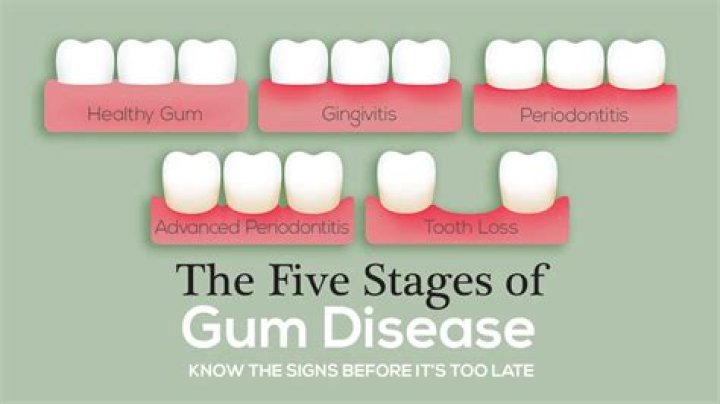 How long does gum take to decompose?