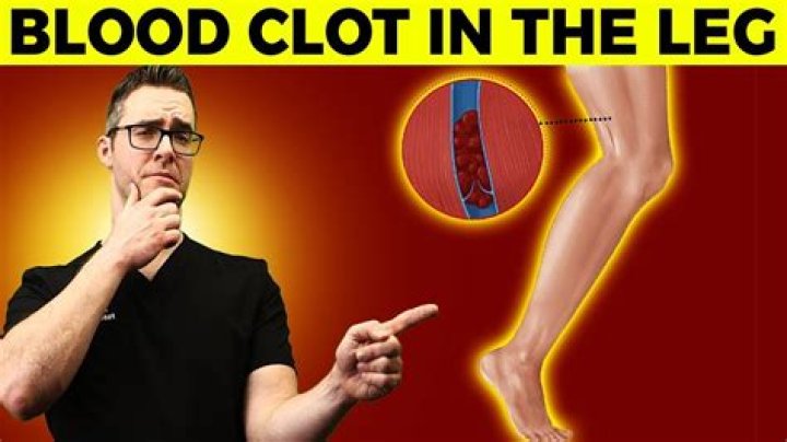 How long does it take a blood clot to move from your leg?