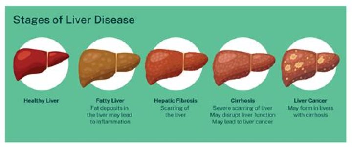 How long does it take for liver inflammation to heal?