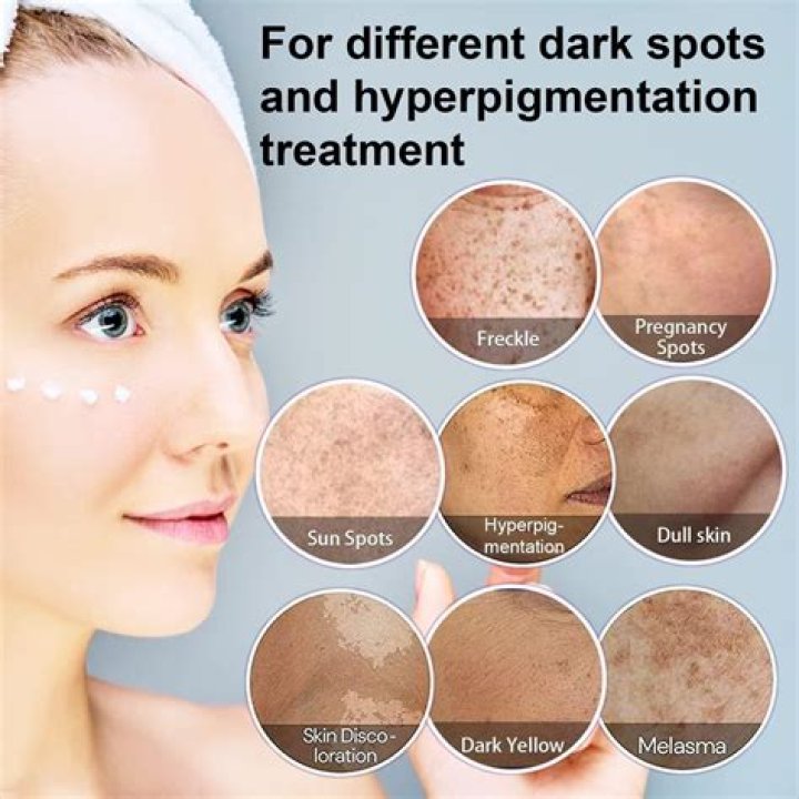 How long does it take for vitamin C serum to fade dark spots?