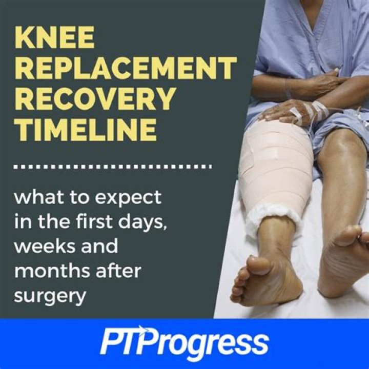 How long does it take to recover from a phlebotomy?