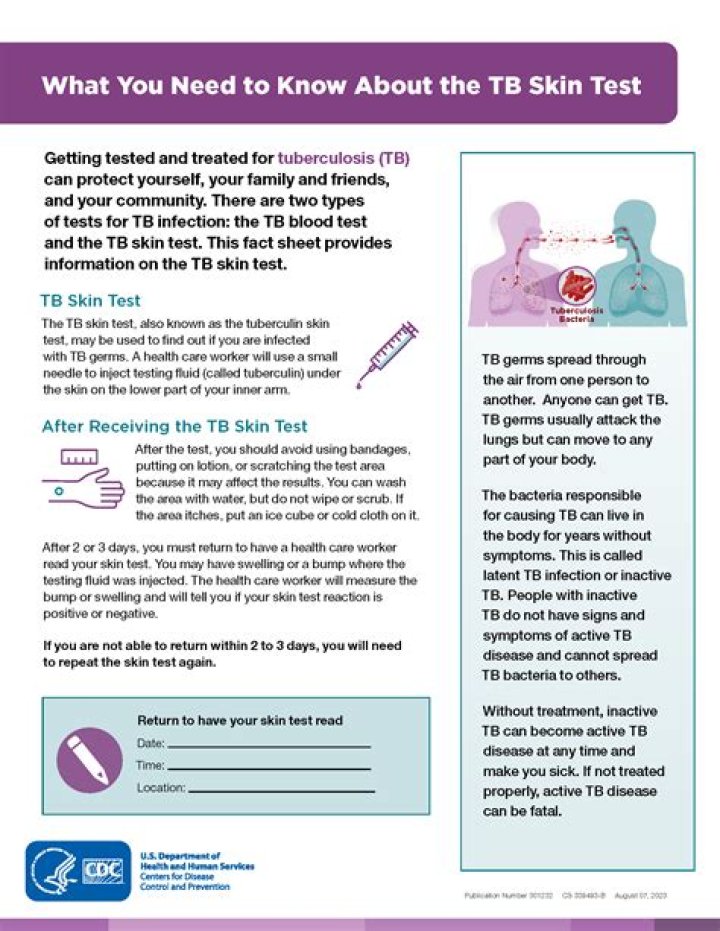 How long does TB test bump last?