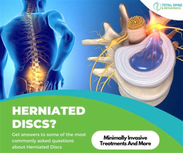How long is the recovery for herniated disc surgery?