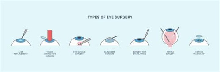 How many surgeries can you have in a lifetime?