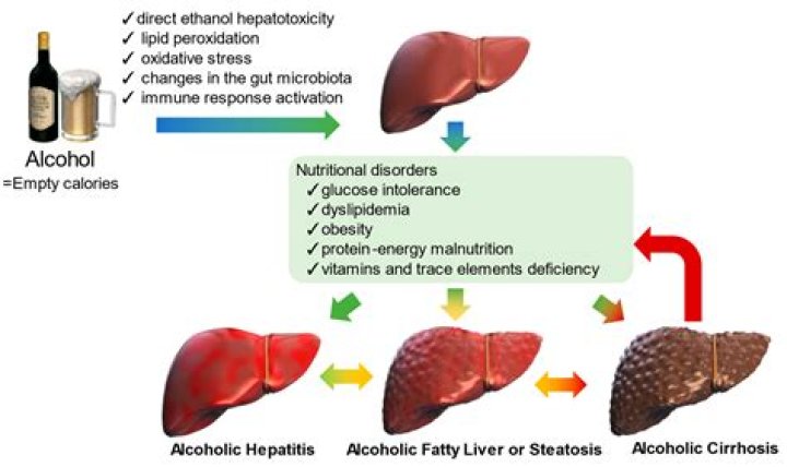 How much do you have to drink to get liver damage?