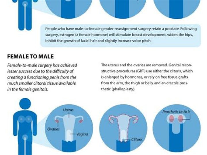 How much does it cost to transition from female to male?