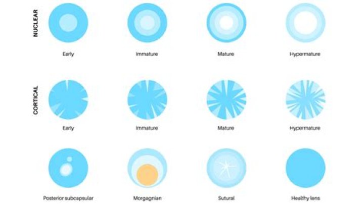 How often do halos occur?