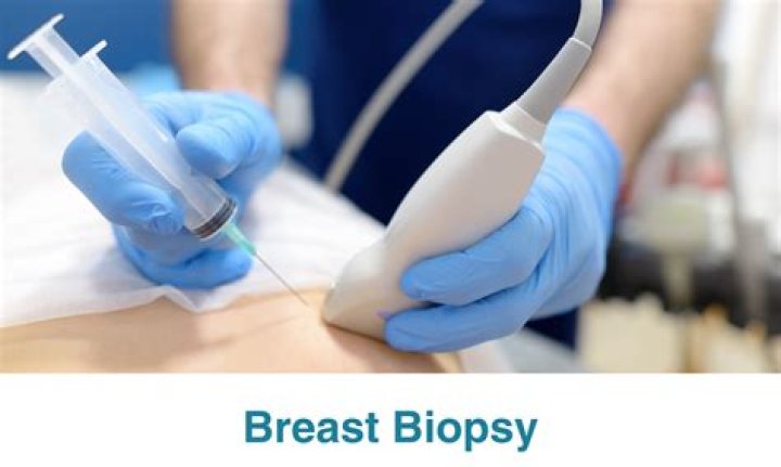 How painful is a biopsy?
