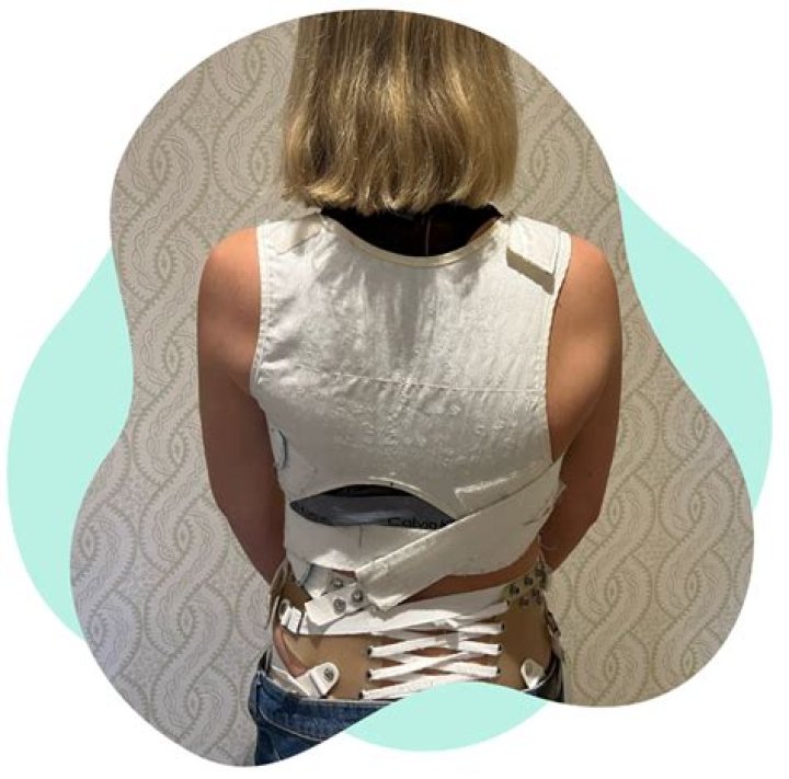Is a brace as good as a cast?