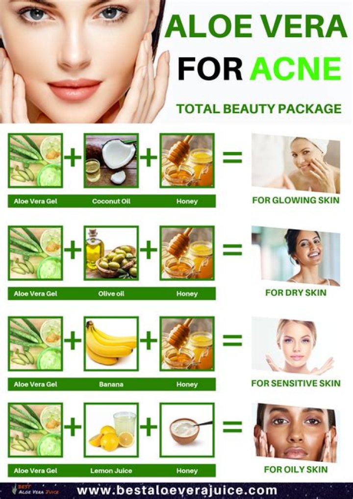 Is Aloe Vera good for acne?