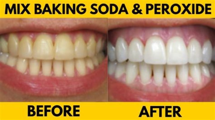 Is baking soda abrasive to teeth?