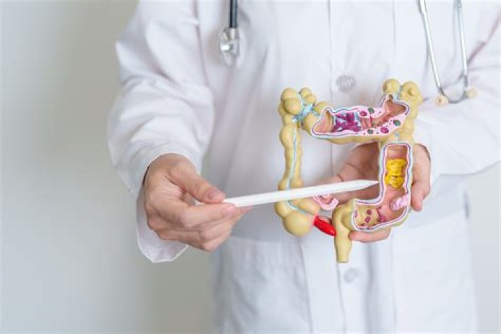 Is cologuard just as good as a colonoscopy?