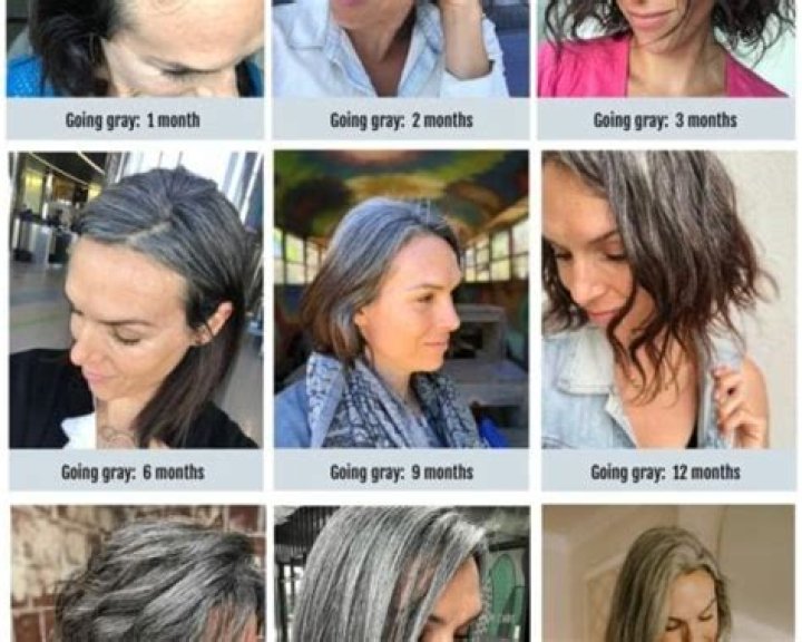 Is GREY hair normal at 15?
