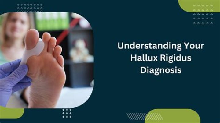 Is hallux rigidus disabled?