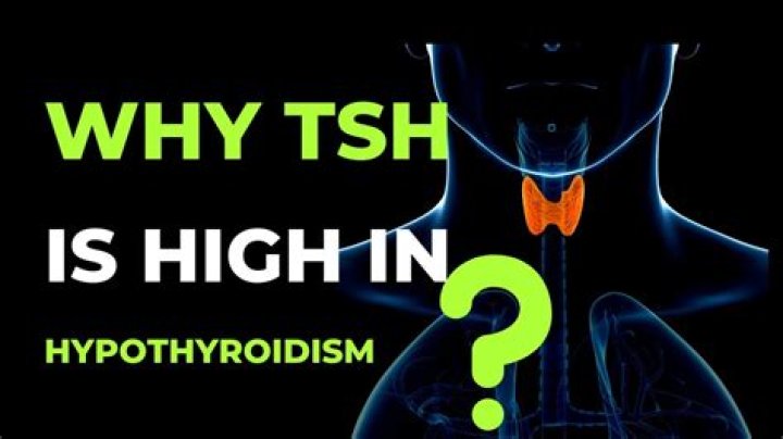 Is high TSH serious?