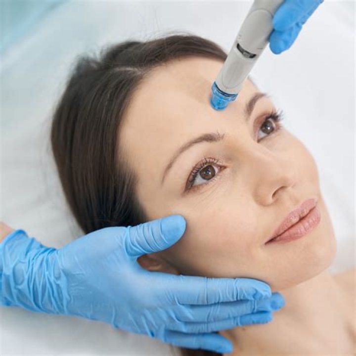 Is HydraFacial good for wrinkles?