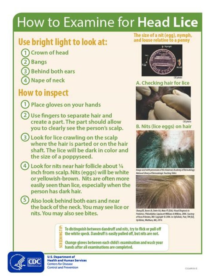 Is it possible to have lice for years?