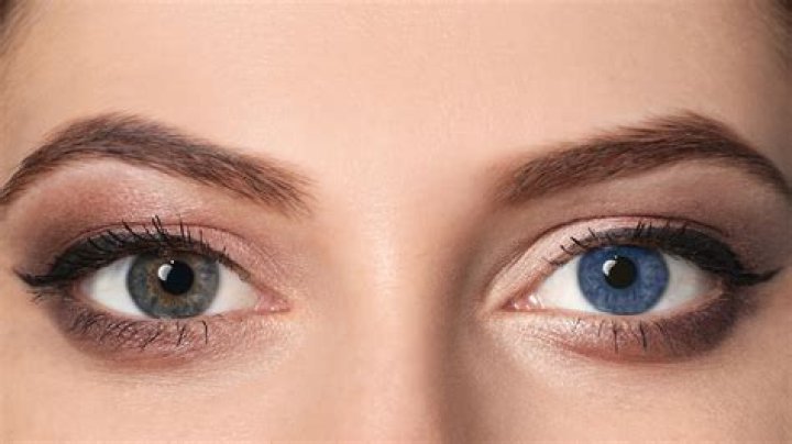 Is it rare to have gray eyes?