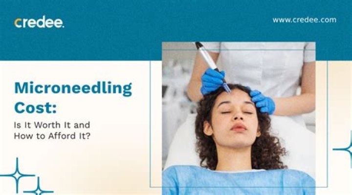 Is microneedling worth the cost?