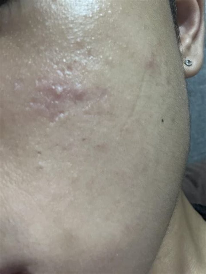 Is my face dry or oily?