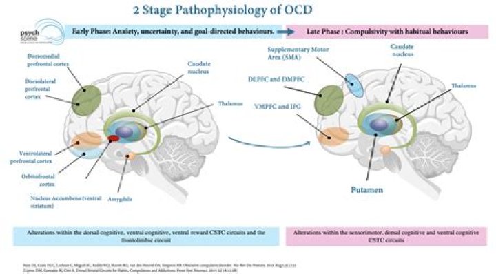 Is OCD a brain disorder?