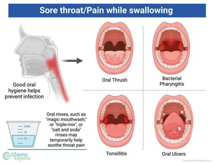 Is sore throat is a symptom of dengue?