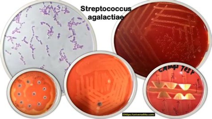 Is Streptococcus agalactiae acid-fast?