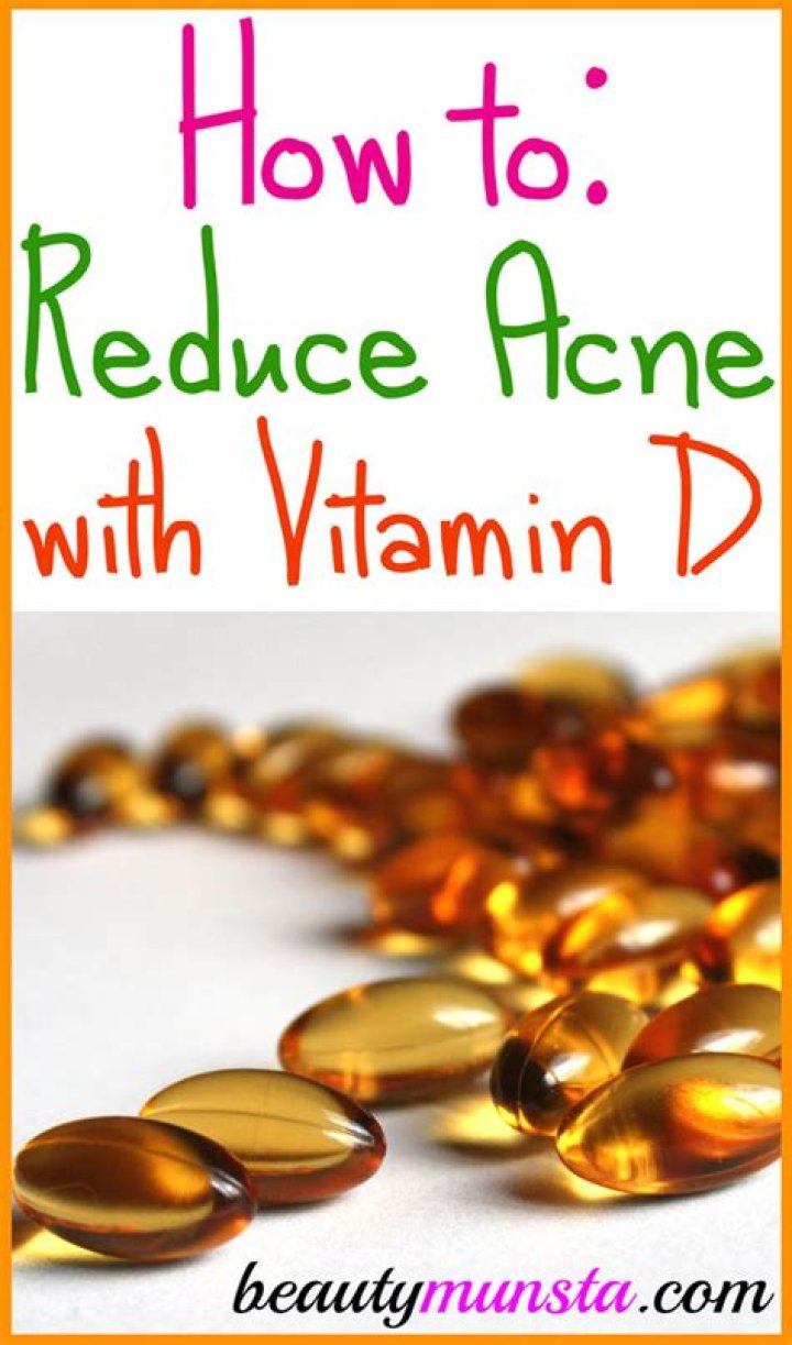 Is vitamin D good for acne?