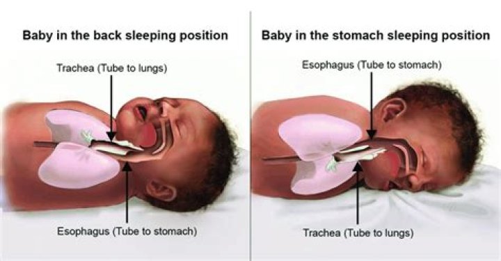 Should babies sleep with hats on?