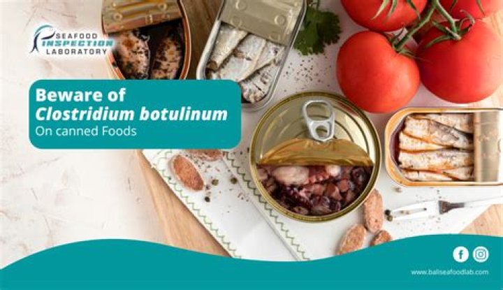 What are 5 food sources for botulism?
