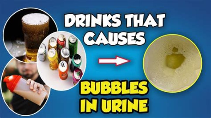 What are drinks that make you pee called?