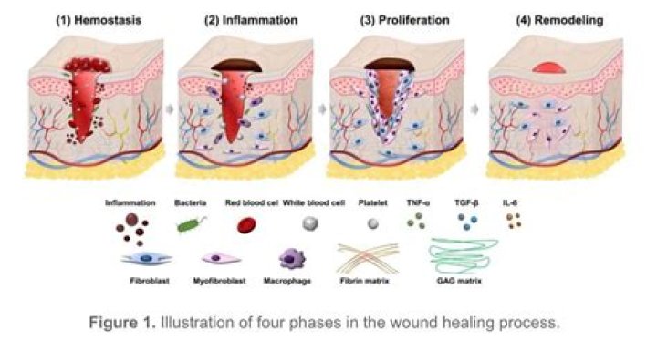 What are the 3 stages of inflammation?