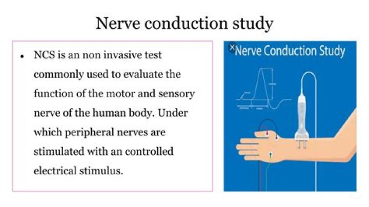 What are the side effects of a nerve conduction test?