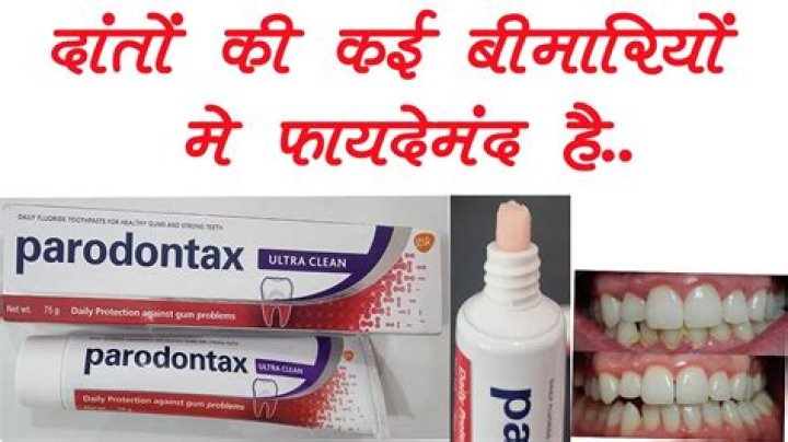 What are the side effects of parodontax?