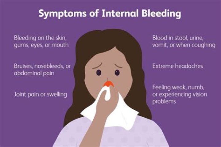 What are the signs of internal bleeding?