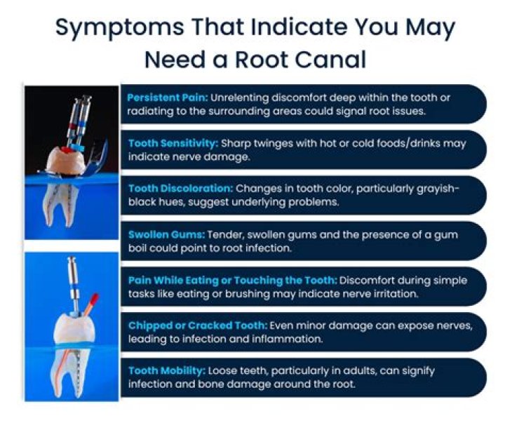 What are the signs you need a root canal?