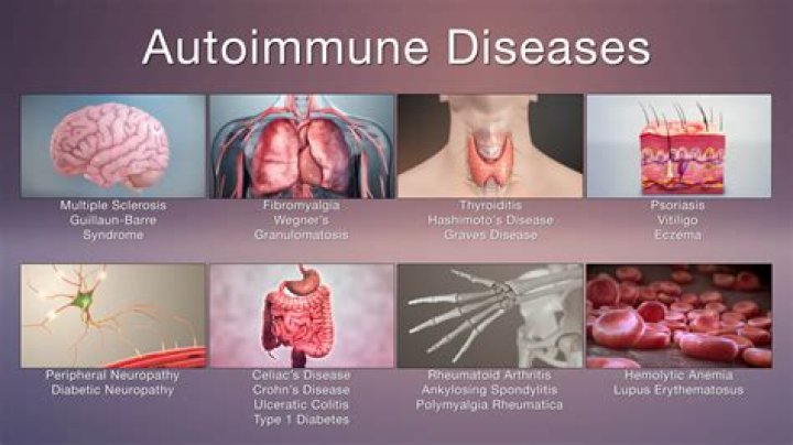 What autoimmune diseases cause thyroid problems?
